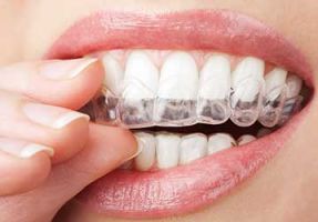 orthodontic dentists in calgary Welcome Smile Dental