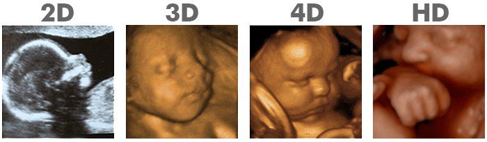 5d ultrasounds in calgary First Peek Baby Ultrasound, Calgary
