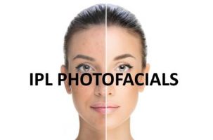 lipolytic laser clinics in calgary Revive Laser and Skin Clinic Inc