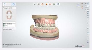 dental implantology courses calgary MyBite Denture Implant Solutions